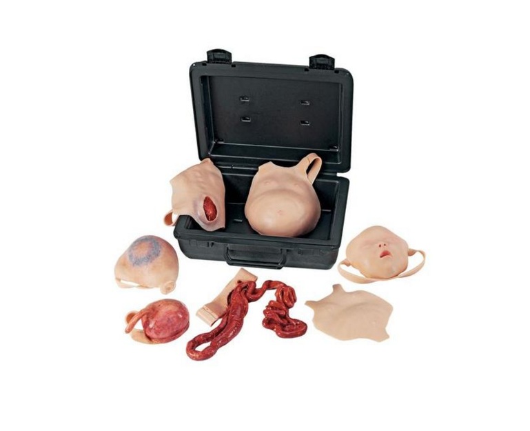 CONJUNTO DE FERIMENTO NEONATAL - M-W19368