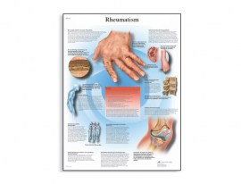 POSTER DE REUMATISMO - M-VR1124L