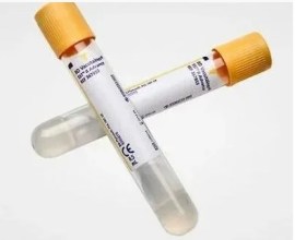 Tubo De Vacuo (Plast) Gel Sst Ii 8,5 Ml - 100 Unid - Bd