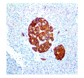 CD56/NCAM-1 Clone 123C3 Pronto Para Uso - 6 Ml - Easypath -  EP-12-50786