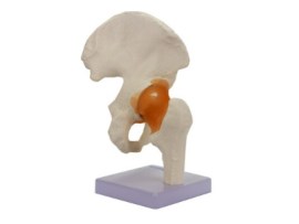 Articulaçao Do Quadril - Jf81