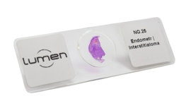 Lâmina Preparada Patologia De Lipoma - He - Lm-109 - Lumen