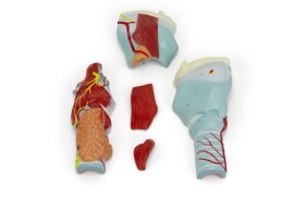 Laringe Ampliado 2 Vezes, 5 Partes - La20