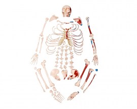 Esqueleto Tamanho Natural Desarticulado Com Origem E Inserção Muscular - TGD-0101-M