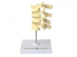 Osteoporose 4 Vértebras - TGD-0155-O