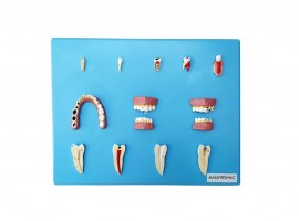 Patologia Dentária Em 12 Peças - TZJ-0311-P