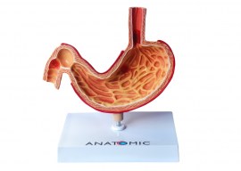 Estômago Com Patologias - TZJ-0326-P